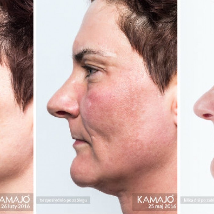 SESDERMA programy gabinetowe