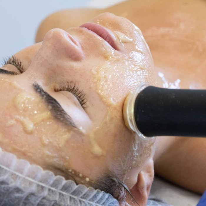 Alma Harmony TM Terapia laserowa