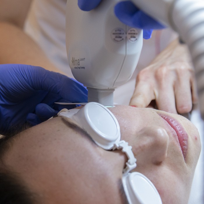 SESDERMA programy gabinetowe