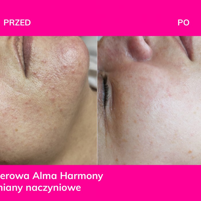 SESDERMA programy gabinetowe